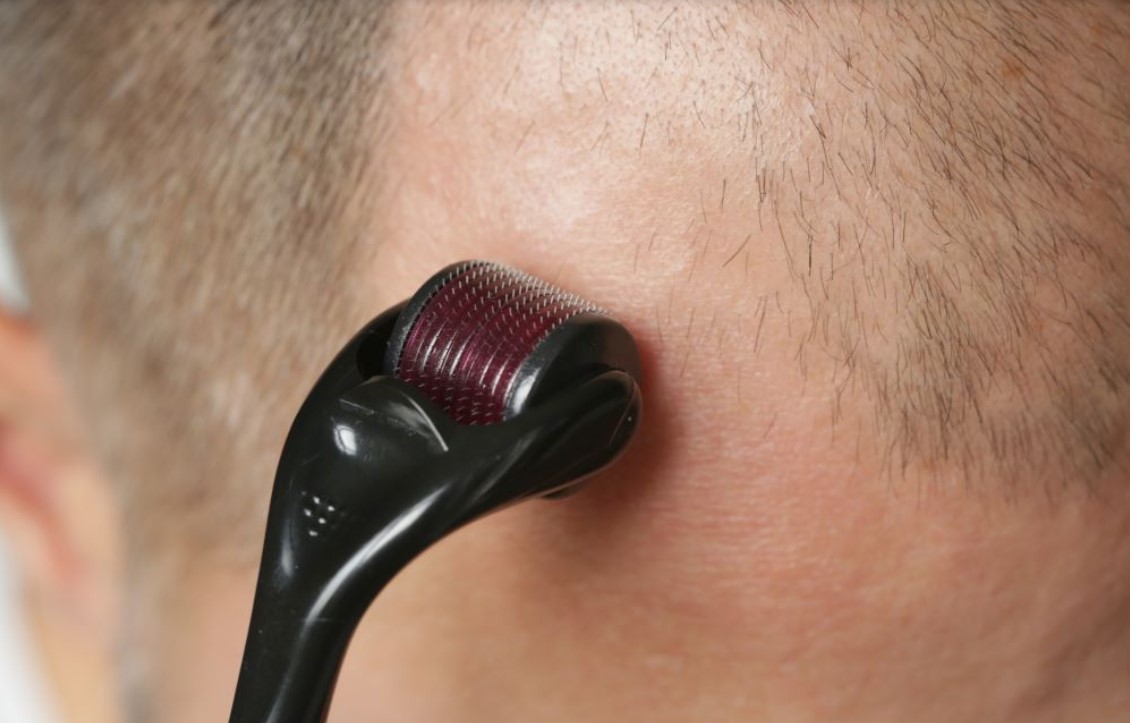 Derma Roller - Image 4