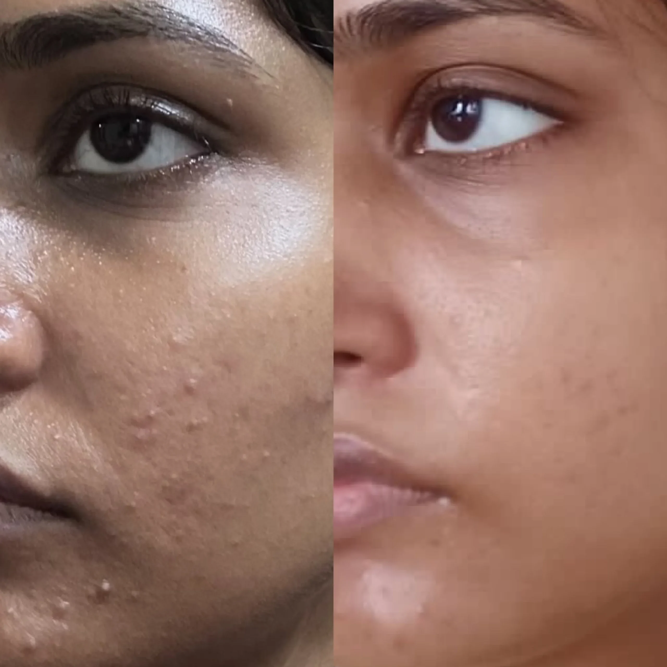 Derma Roller - Image 6